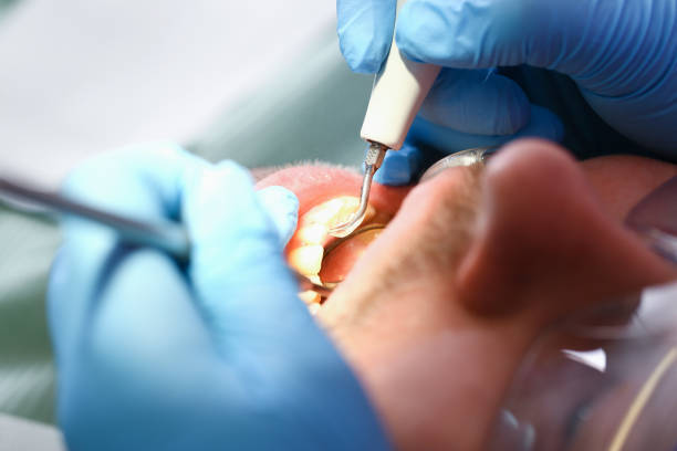 Best Emergency Dentist Near Me  in Cottonport, LA