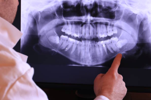Best Urgent Tooth Repair  in Cottonport, LA